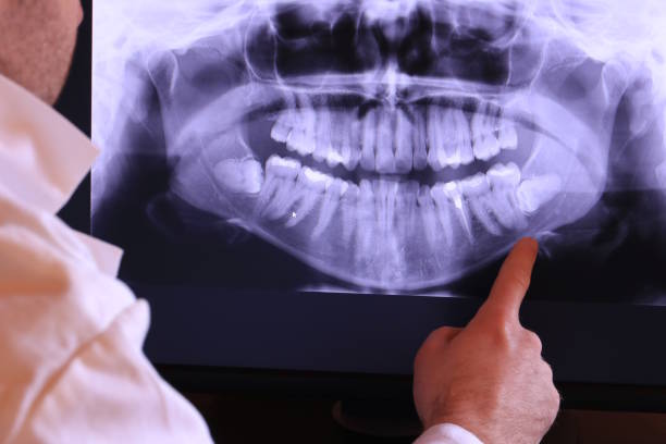 Best Emergency Tooth Extraction in Bonneauville, PA