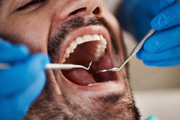 Best Emergency Tooth Extraction in Bonneauville, PA